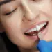 dental veneers for missing teeth